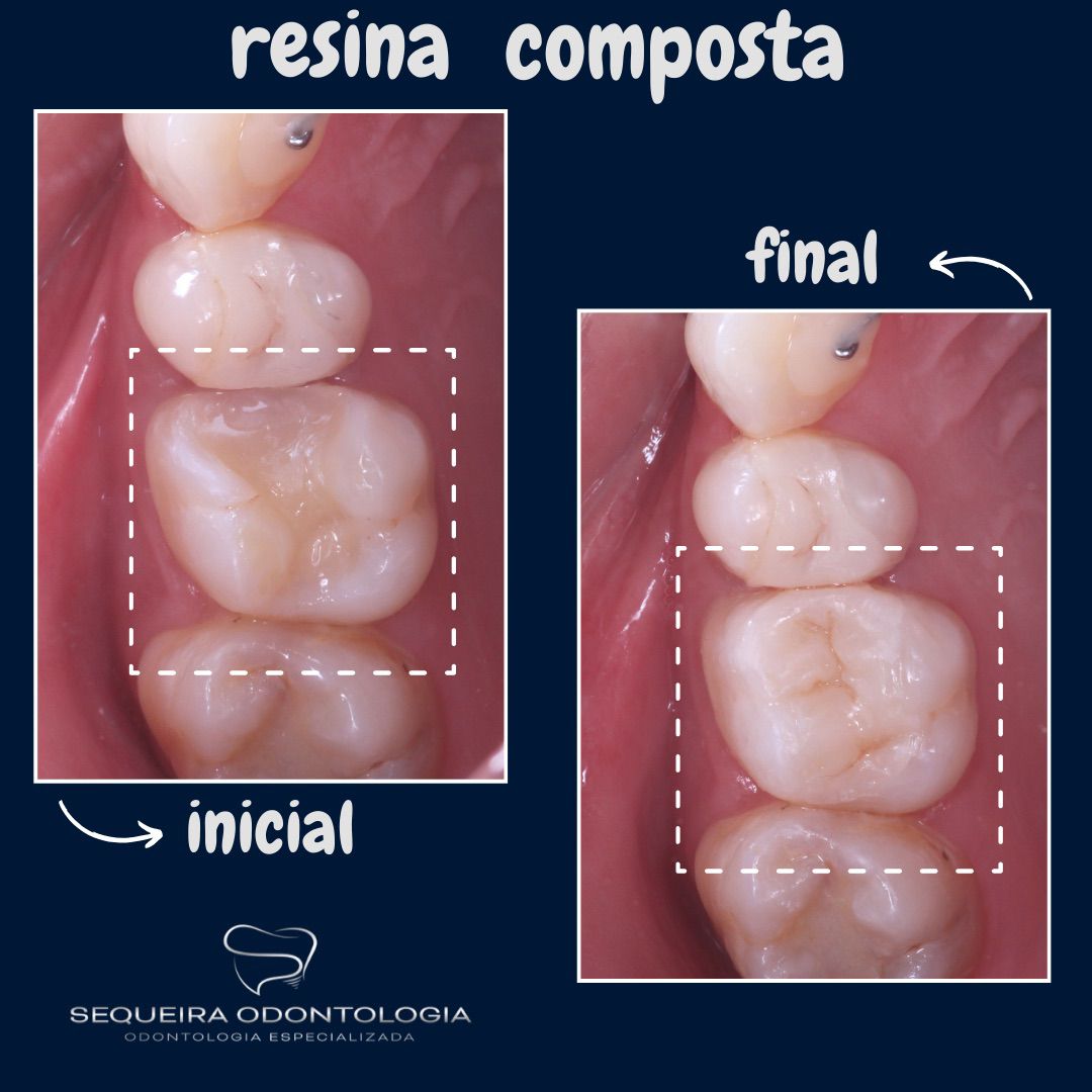 Caso 2